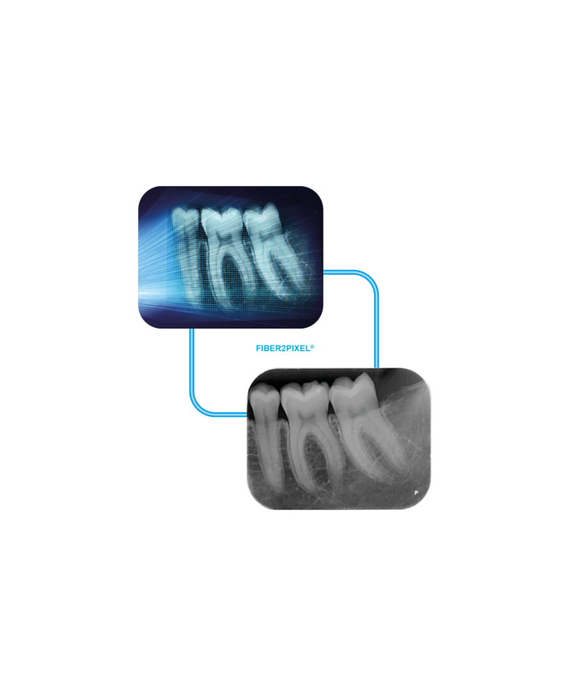 PSPIX® 2 - ACTEON