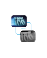 PSPIX® 2 - ACTEON